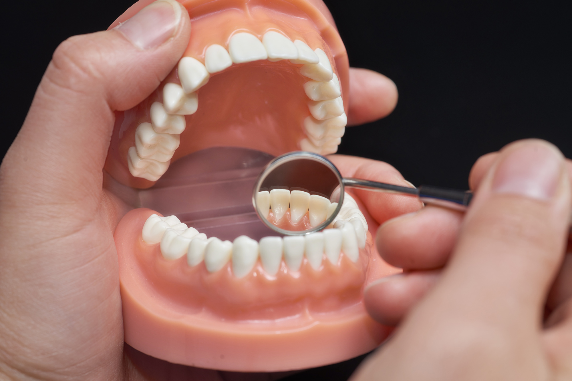 What's Better, Dental Crown Or Bridge? Expert Advice What's Better, Dental Crown Or Bridge? Expert Advice