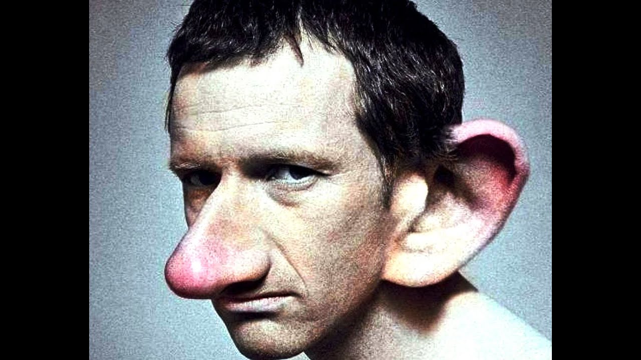 When Does Nose Stop Growing? Expert Answers When Does Nose Stop Growing? Expert Answers