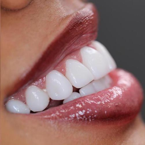 When To Choose Composite Resin? Smile Repair Guide