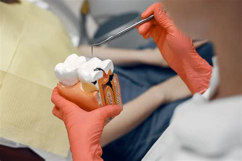 When To Choose Pulpectomy? Expert Advice