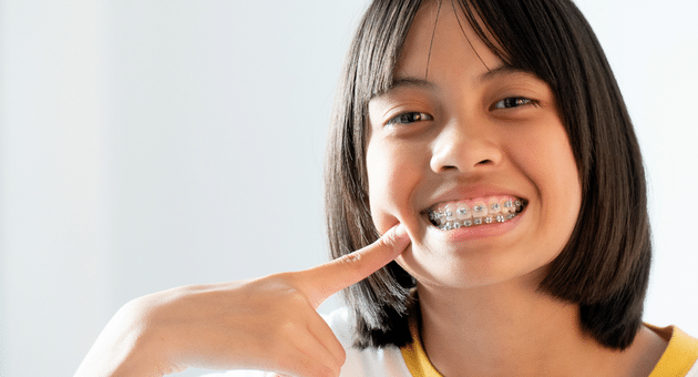 Where To Get Cheap Braces