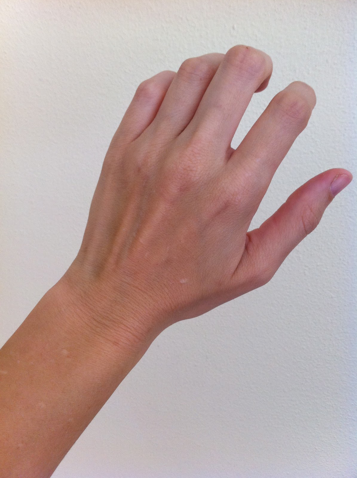 Why Are My Wrists Cracking