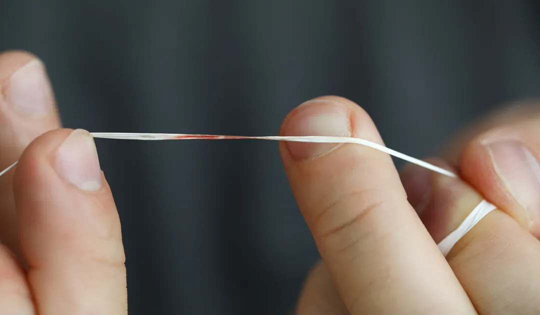 Why Do Gums Bleed? Stop Flossing Pain Why Do Gums Bleed? Stop Flossing Pain