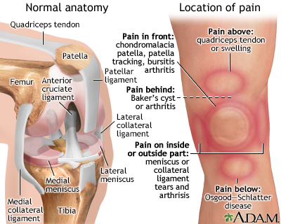 Why Does Inner Knee Hurt After Running? Instant Relief