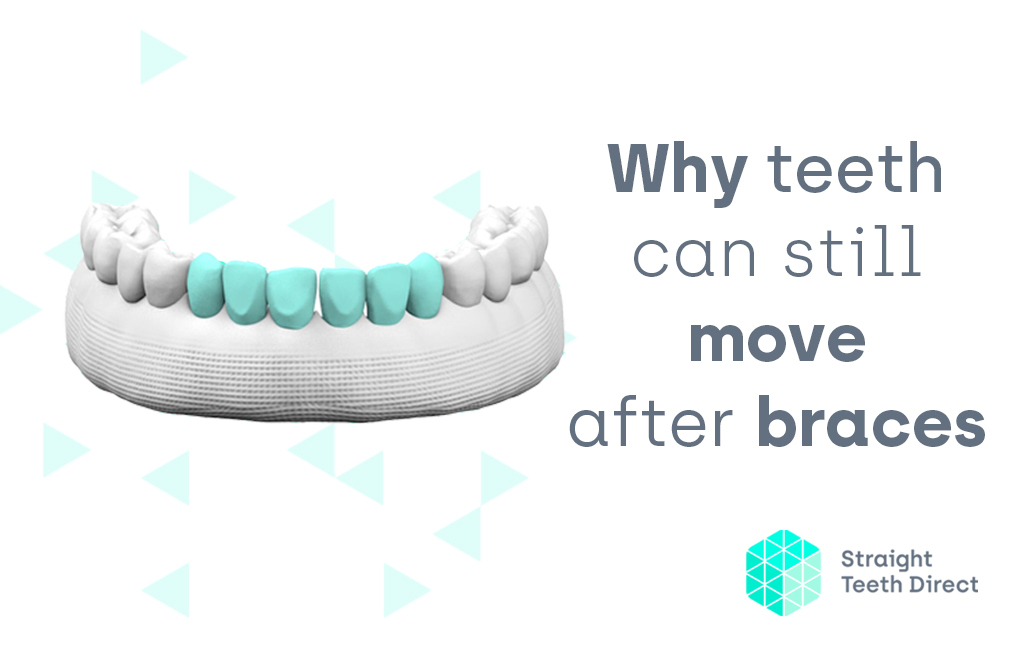 Why Does Teeth Move