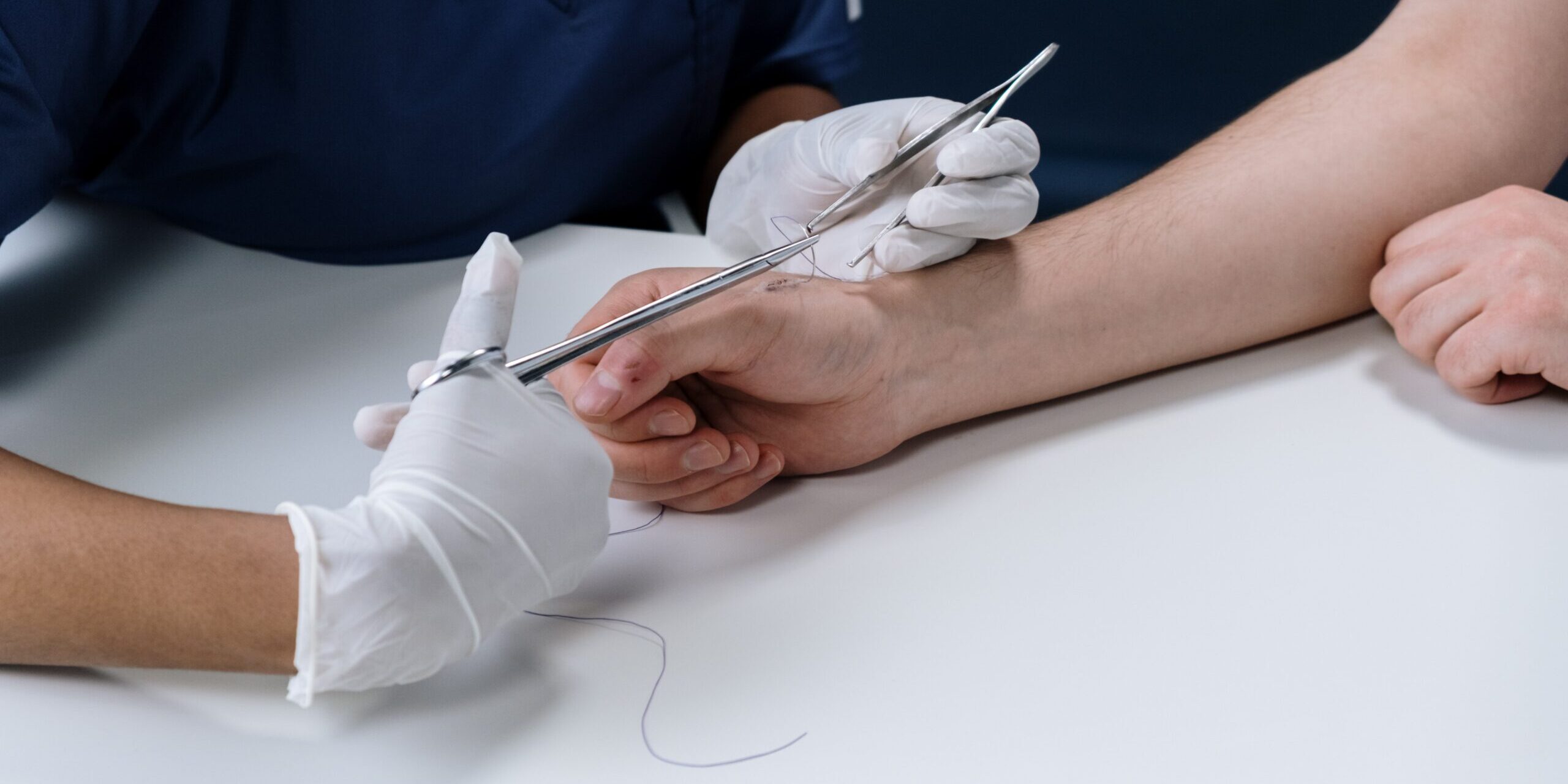 Wounds That Require Stitches: Healing Guide